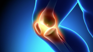 ACL Injury Prevention course from NFHS